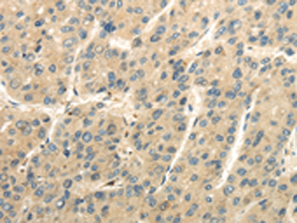 UBAP2L Antibody