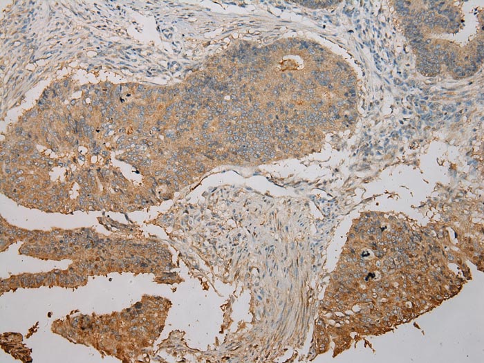 UBE2B Antibody