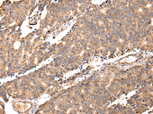 UGGT2 Antibody