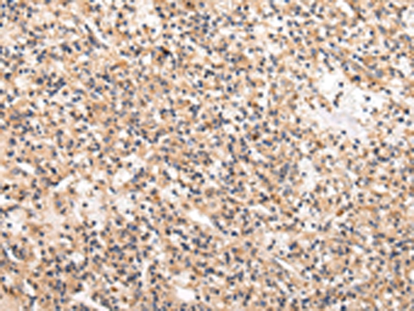USP5 Antibody