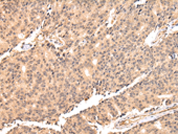 USP45 Antibody