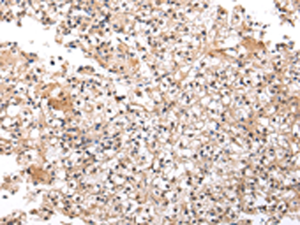 UXT Antibody