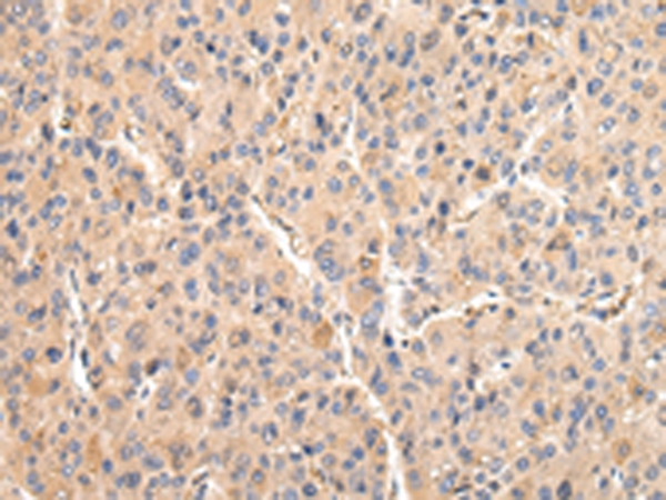 VCAM1 Antibody