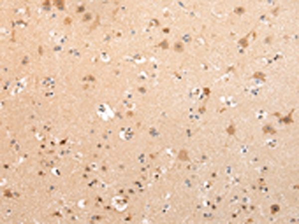 VPS16 Antibody