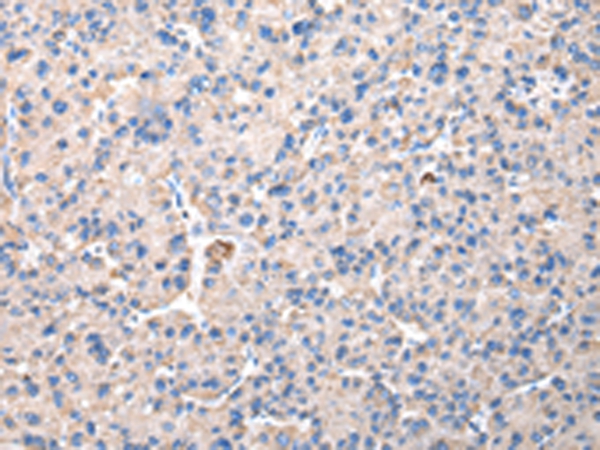 CHMP3 Antibody