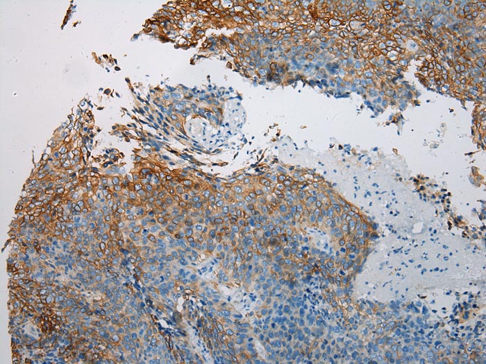 VPS33A Antibody