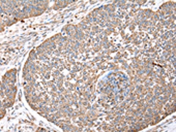 DPH7 Antibody