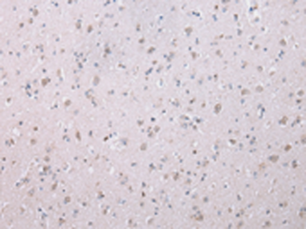 WISP3 Antibody