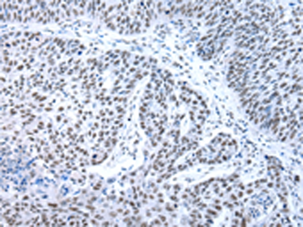 XAB2 Antibody