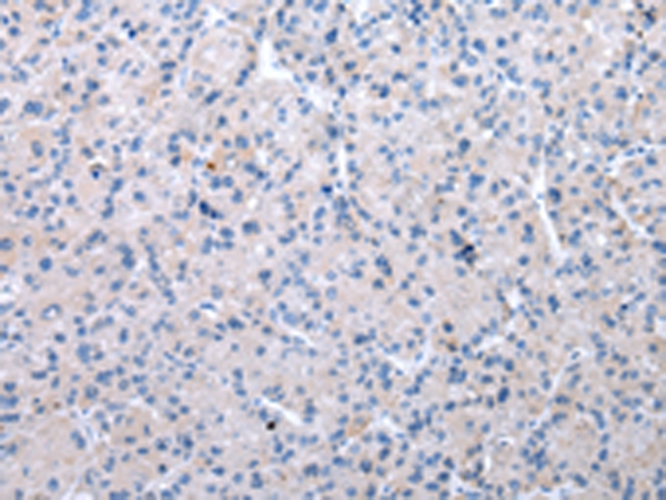 XKR6 Antibody