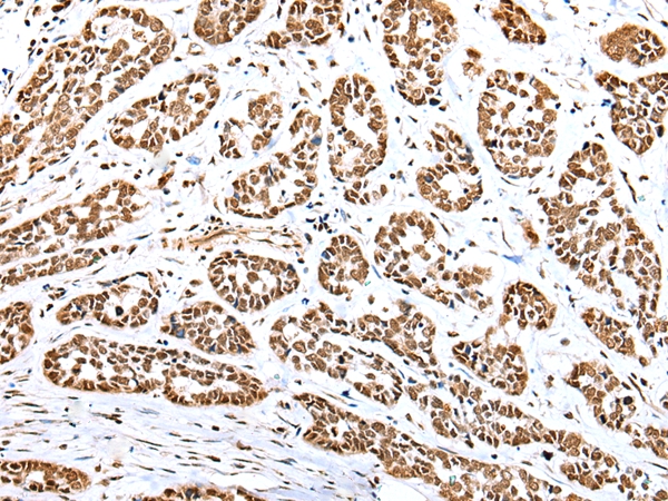 YY1 Antibody