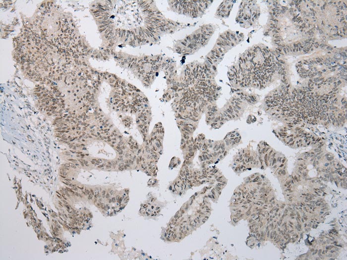 YY1AP1 Antibody