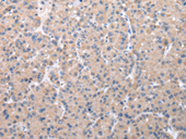 ZDHHC20 Antibody