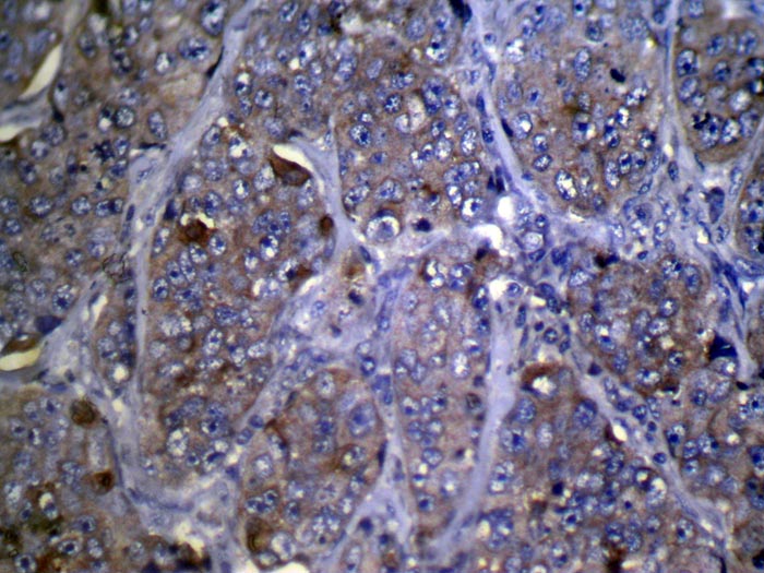 ZFP2 Antibody