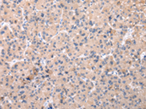 ZNF268 Antibody