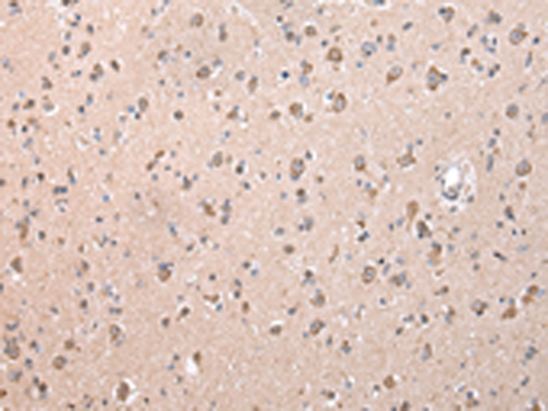 ZCCHC9 Antibody