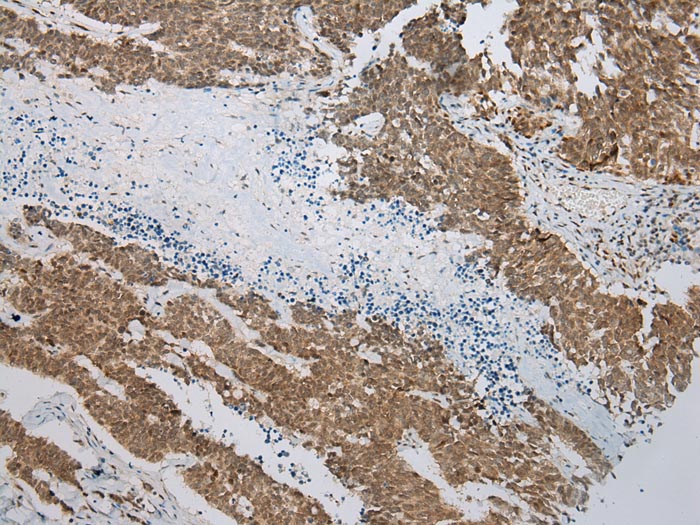 TIGD5 Antibody