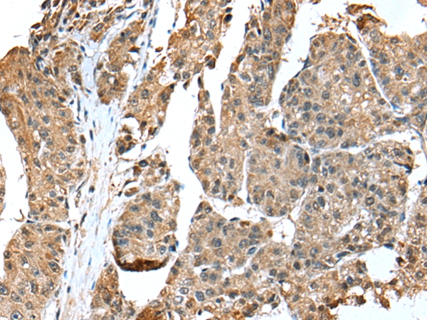 EML4 Antibody