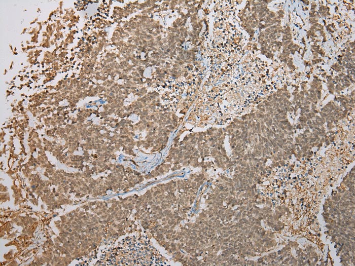 FNDC3B Antibody