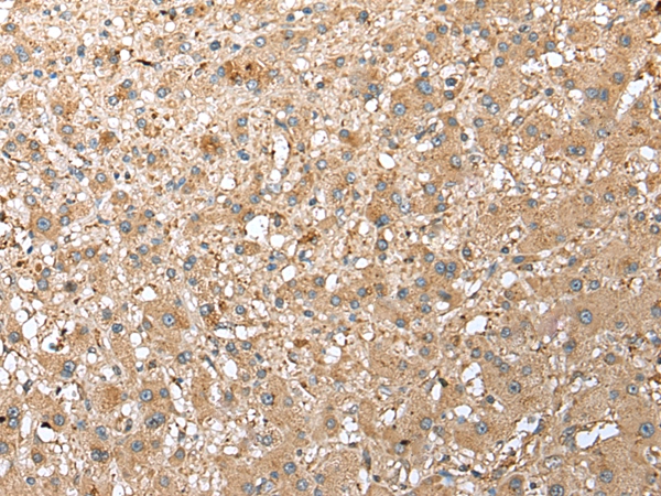 RPS21 Antibody
