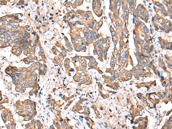 RABL2B Antibody