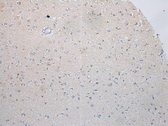 ICK Antibody