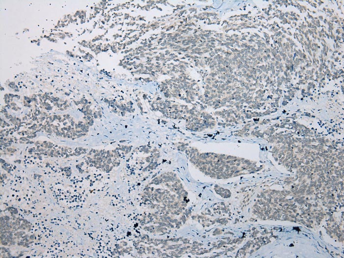 CRYZL1 Antibody