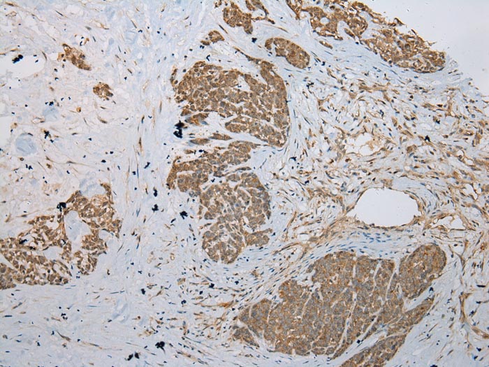 KRT222 Antibody