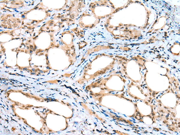 DTWD1 Antibody