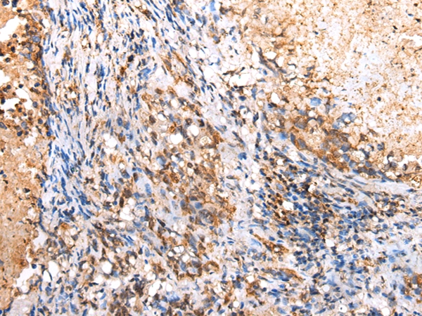 RIMKLB Antibody