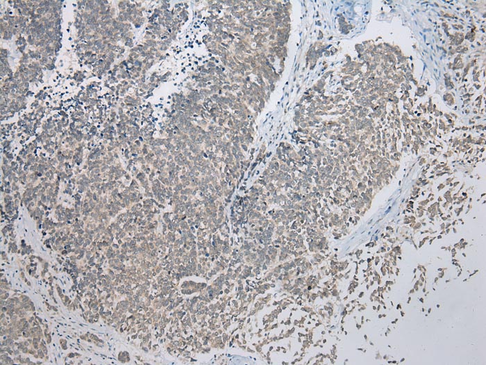 CBWD1 Antibody