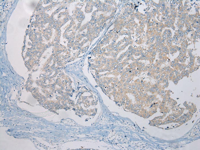 LSM11 Antibody