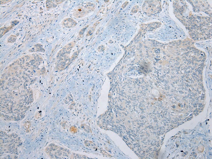 UBXN2B Antibody
