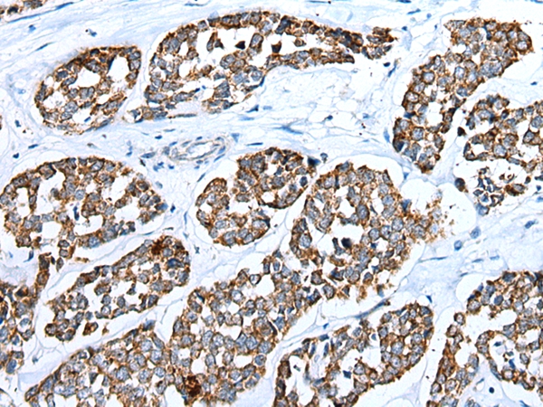 RHOV Antibody