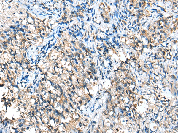 CFB Antibody