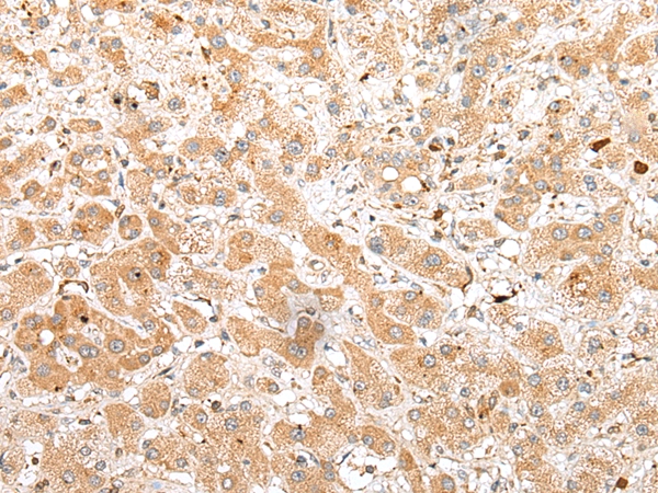 FKBP6 Antibody