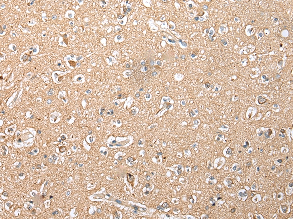 RFK Antibody