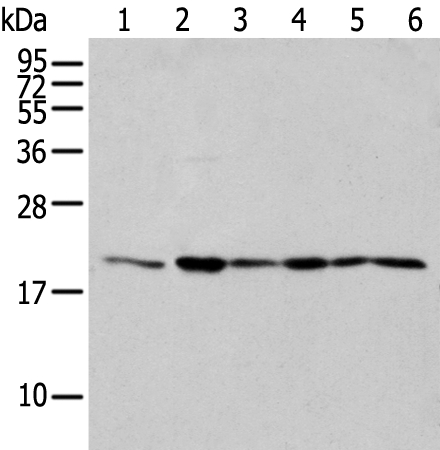 EEF1E1 Antibody