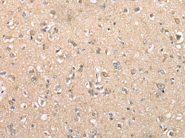 DYDC2 Antibody