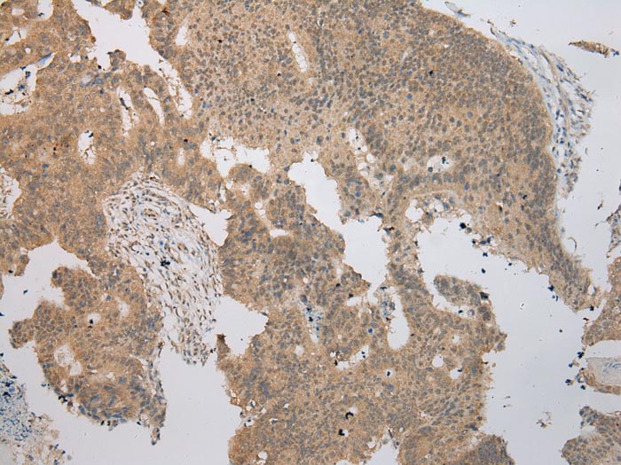 TRNAU1AP Antibody