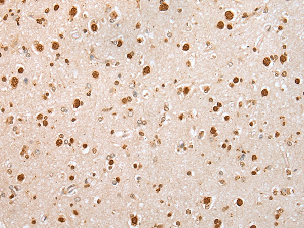 KHDRBS3 Antibody