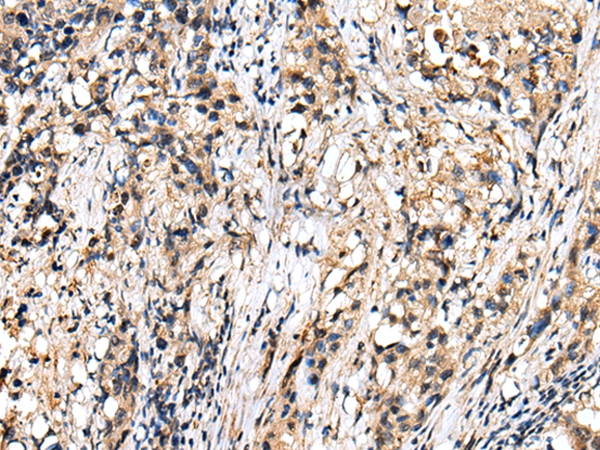 RHEBL1 Antibody