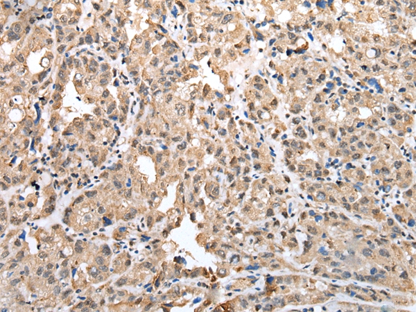 CSRP3 Antibody