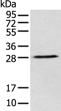 DENR Antibody
