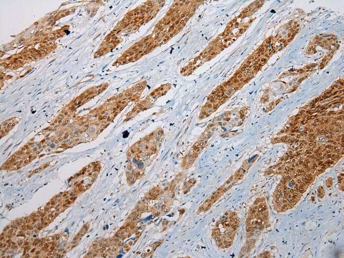 GSTM4 Antibody