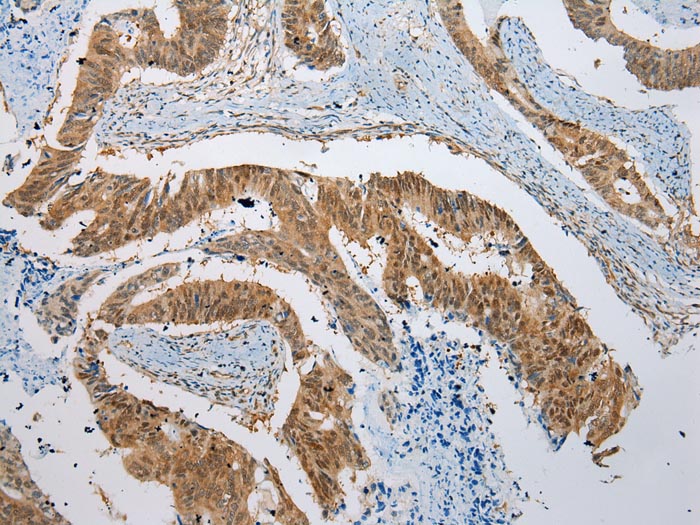NUDCD3 Antibody