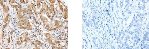 ZNF672 Antibody