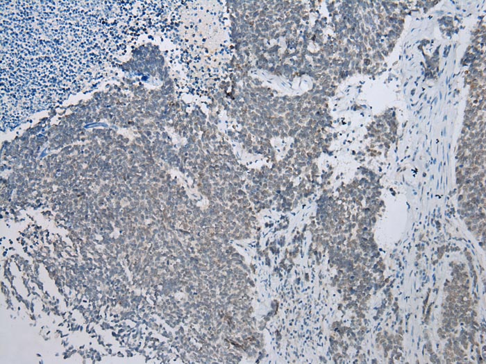 NAA60 Antibody