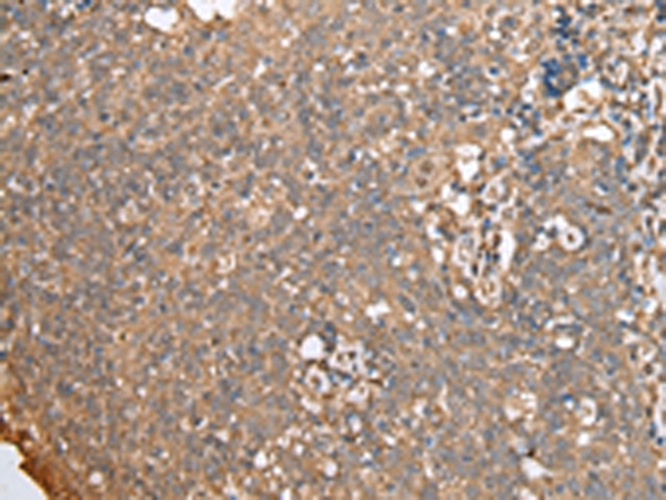 ECI1 Antibody