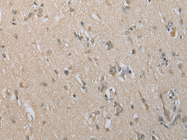 DECR2 Antibody